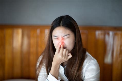 鼻子變紅|酒糟鼻原因+5大鼻頭紅腫改善治療、 食療懶人包